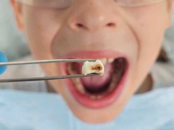 Best Emergency Cosmetic Dentistry (e.g., broken veneers) in Lone Star, TX